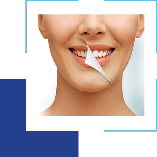 The Advantages You Can Enjoy By Getting Teeth Whitening Treatment at a Dental Clinic